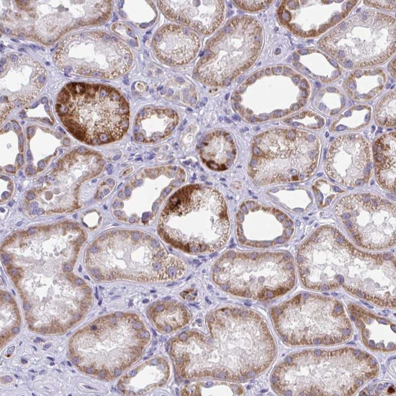 Immunohistochemical staining of human kidney shows strong cytoplasmic positivity in cells in tubules.