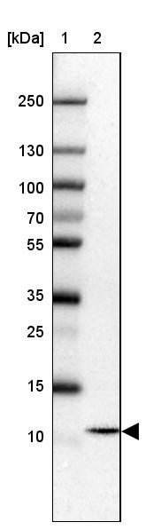 Lane 1: Marker [kDa] 250, 130, 100, 70, 55, 35, 25, 15, 10<br/>Lane 2: Human cell line HepG2