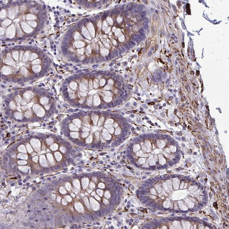 Immunohistochemical staining of human colon shows moderate cytoplasmic positivity in glandular cells.