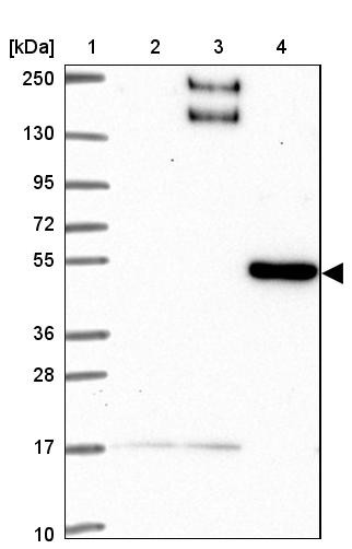Lane 1: Marker [kDa] 250, 130, 95, 72, 55, 36, 28, 17, 10<br/>Lane 2: Human cell line RT-4<br/>Lane 3: Human cell line U-251MG sp<br/>Lane 4: Human plasma (IgG/HSA depleted)
