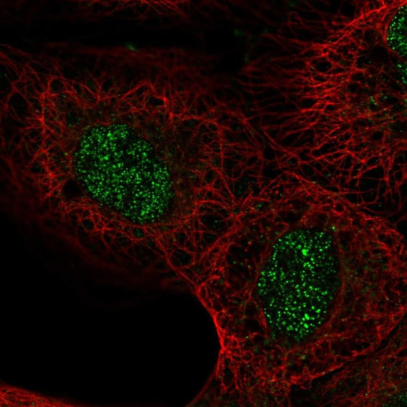 Immunofluorescent staining of human cell line A-431 shows localization to nucleoplasm.