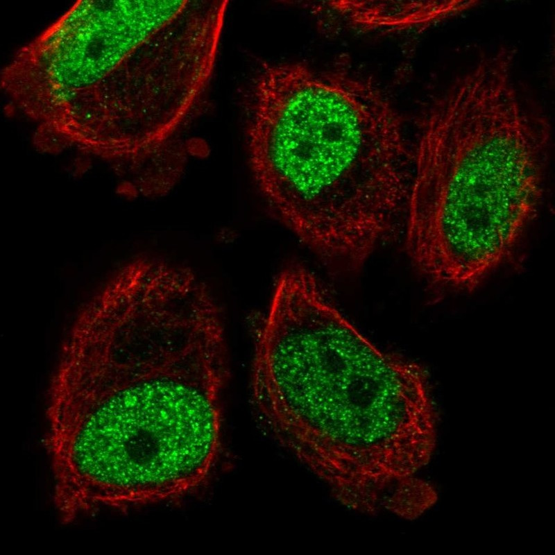 Immunofluorescent staining of human cell line PC-3 shows localization to nucleoplasm.