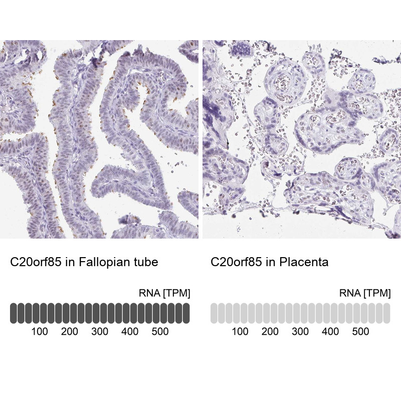 Immunohistochemistry analysis in human fallopian tube and placenta tissues using Anti-C20orf85 antibody. Corresponding C20orf85 RNA-seq data are presented for the same tissues.