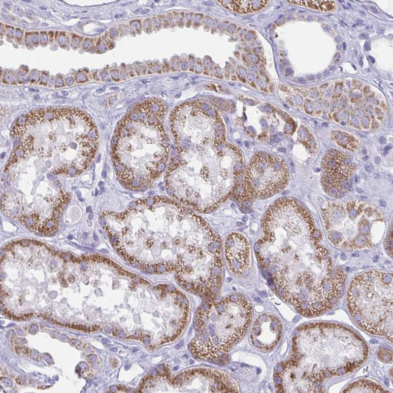 Immunohistochemical staining of human kidney shows strong granular cytoplasmic positivity in cells in tubules.