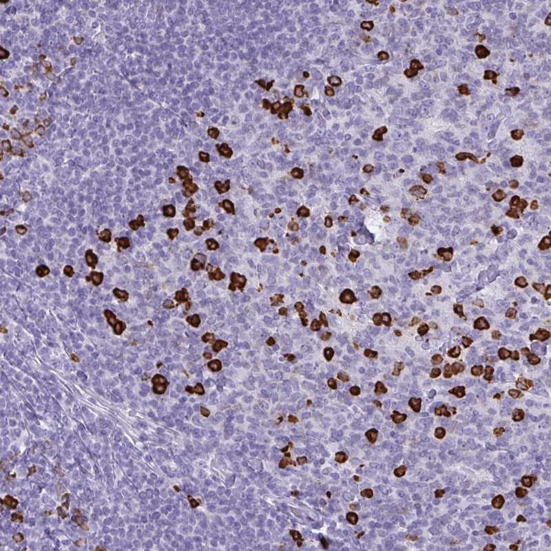 Immunohistochemical staining of human tonsil shows strong cytoplasmic positivity in subset of germinal and non-germinal center cells.