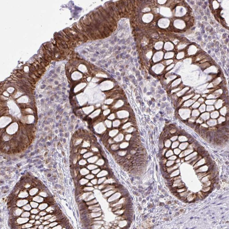 Immunohistochemical staining of human rectum shows strong cytoplasmic and membranous positivity in glandular cells.