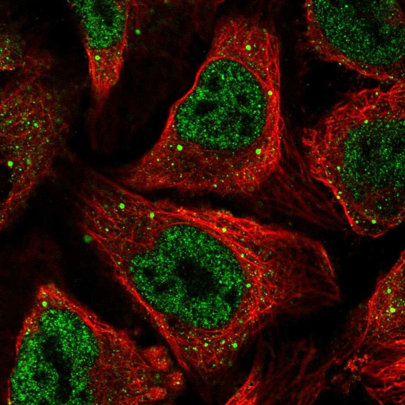 Immunofluorescent staining of human cell line U-2 OS shows localization to nucleoplasm & vesicles.