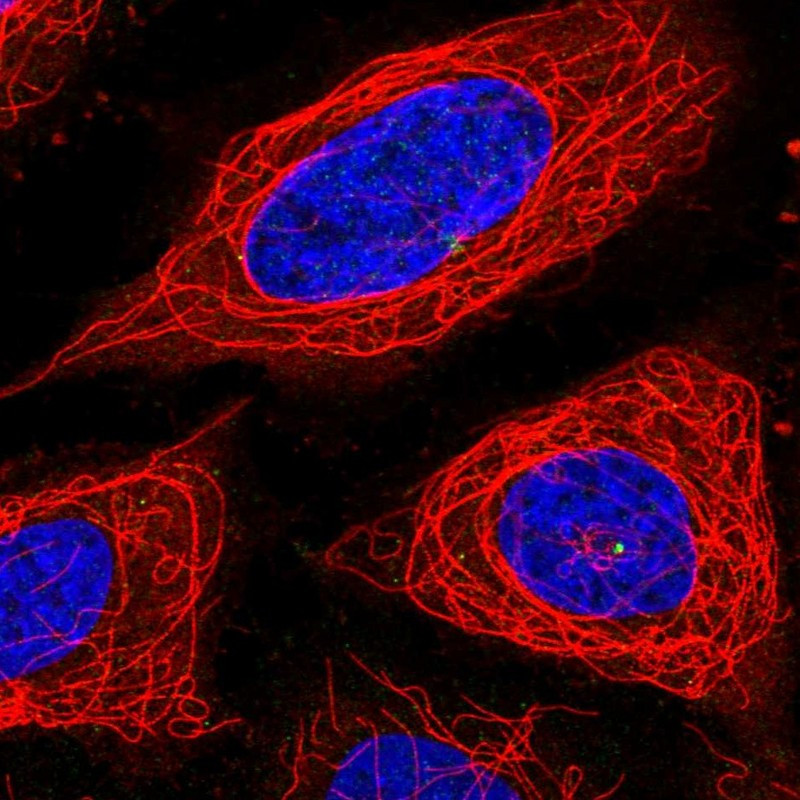 Immunofluorescent staining of human cell line SiHa shows localization to centrosome.