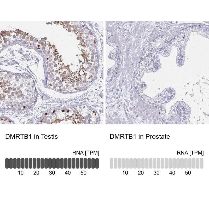 Immunohistochemistry analysis in human testis and prostate tissues using Anti-DMRTB1 antibody. Corresponding DMRTB1 RNA-seq data are presented for the same tissues.