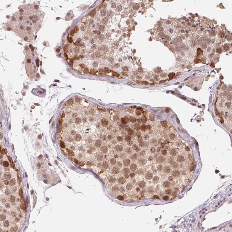 Immunohistochemical staining of human testis shows moderate nuclear and cytoplasmic positivity in cells in seminiferous ducts, Leydig cells.