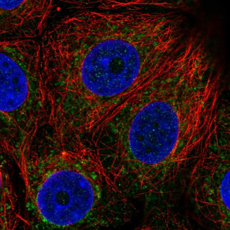 Immunofluorescent staining of human cell line MCF7 shows localization to mitochondria.