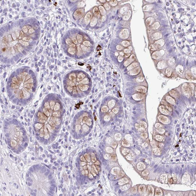 Immunohistochemical staining of human small intestine shows distinct positivity in a subset of leukocytes.