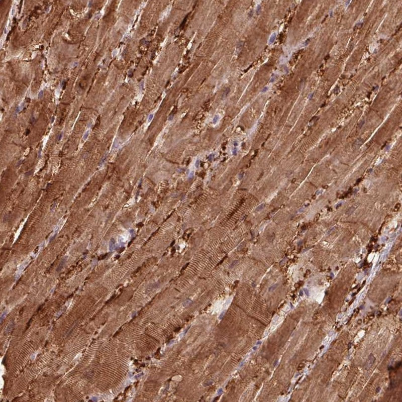 Immunohistochemical staining of human heart muscle shows strong cytoplasmic and membranous positivity in myocytes.