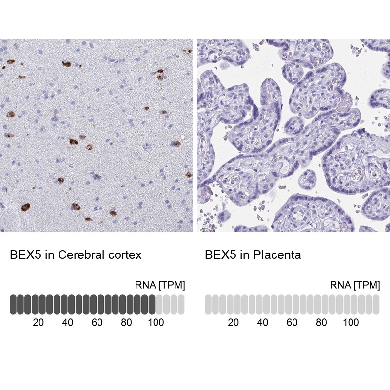 Immunohistochemistry analysis in human cerebral cortex and placenta tissues using Anti-BEX5 antibody. Corresponding BEX5 RNA-seq data are presented for the same tissues.