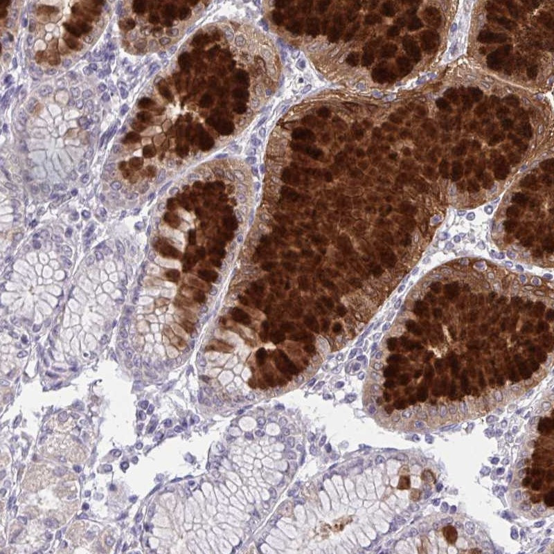 Immunohistochemical staining of human stomach, upper shows strong cytoplasmic positivity in superficial mucosal cells.