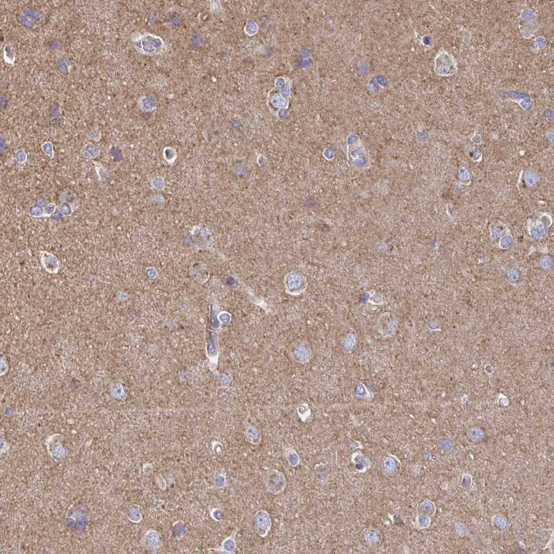 Immunohistochemical staining of human cerebral cortex shows moderate cytoplasmic positivity in neuropil.