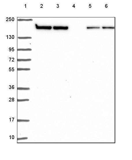 Lane 1: Marker [kDa] 250, 130, 95, 72, 55, 36, 28, 17, 10<br/>Lane 2: Human cell line RT-4<br/>Lane 3: Human cell line U-251 MG<br/>Lane 4: Human plasma<br/>Lane 5: Human Liver tissue<br/>Lane 6: Human Tonsil tissue