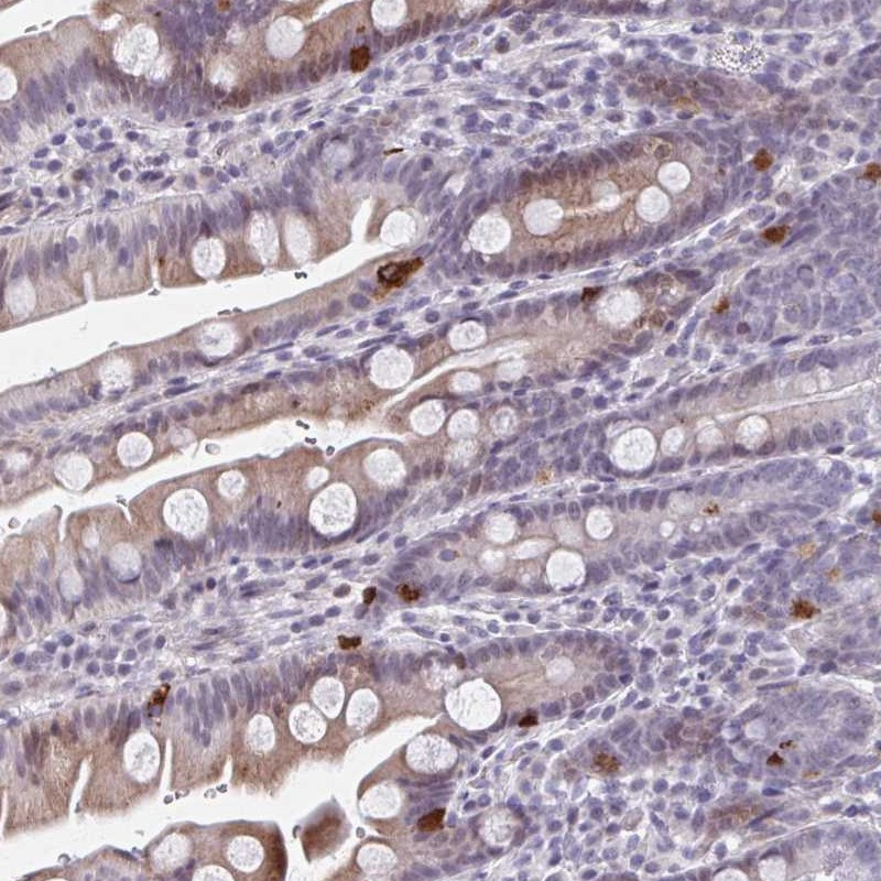 Immunohistochemical staining of human small intestine shows strong cytoplasmic positivity in enteroendocrine cells in glands.