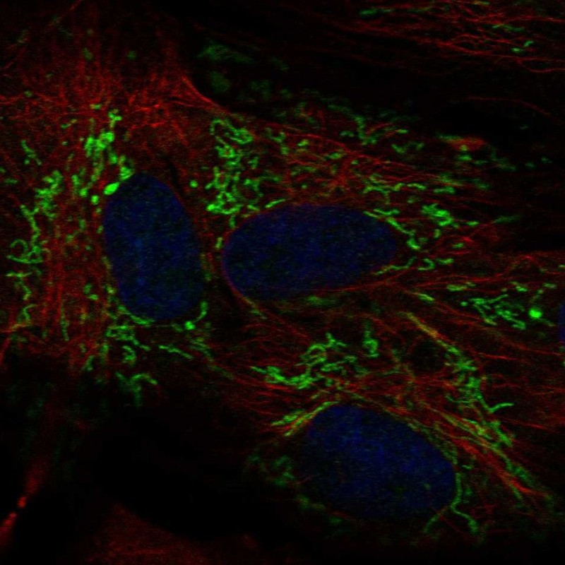 Immunofluorescent staining of human cell line BJ shows localization to mitochondria.