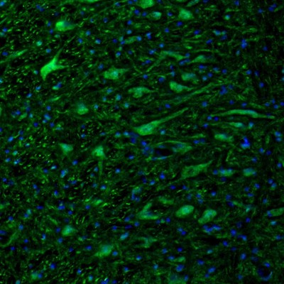 Immunofluorescence staining of mouse pons shows strong cytoplasmic positivity in neurons of the  motor trigeminal nucleus.
