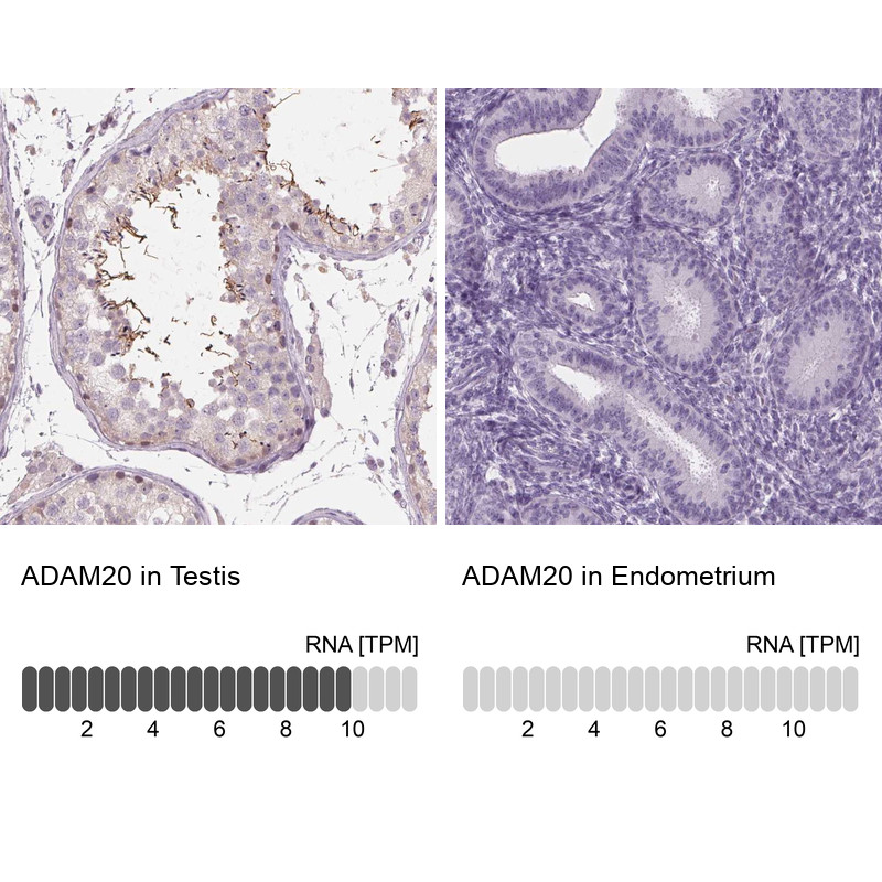 Immunohistochemistry analysis in human testis and endometrium tissues using Anti-ADAM20 antibody. Corresponding ADAM20 RNA-seq data are presented for the same tissues.