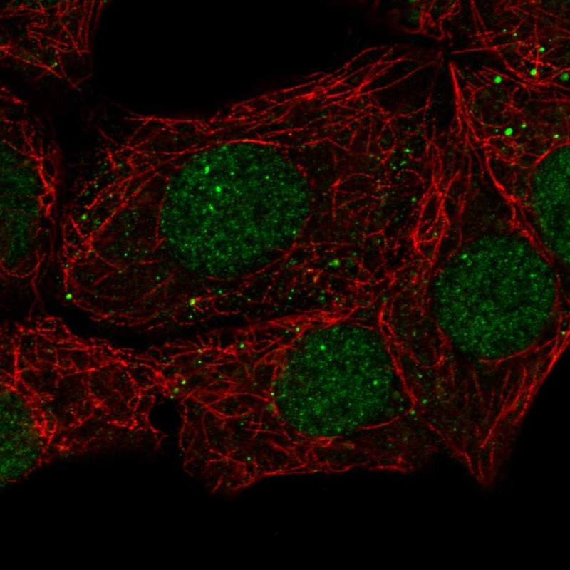 Immunofluorescent staining of human cell line MCF7 shows localization to nucleoplasm, nuclear bodies & vesicles.