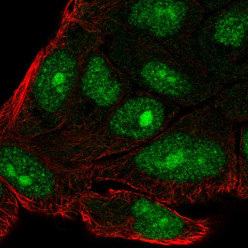 Immunofluorescent staining of human cell line RT4 shows localization to nucleus & nucleoli.