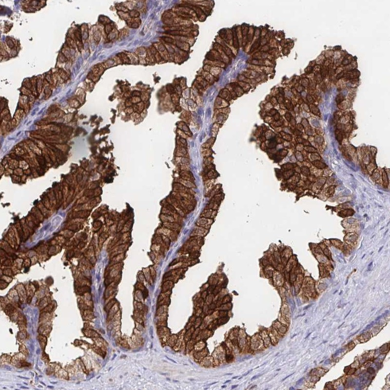 Immunohistochemical staining of human prostate shows strong cytoplasmic and membranous positivity in glandular cells.