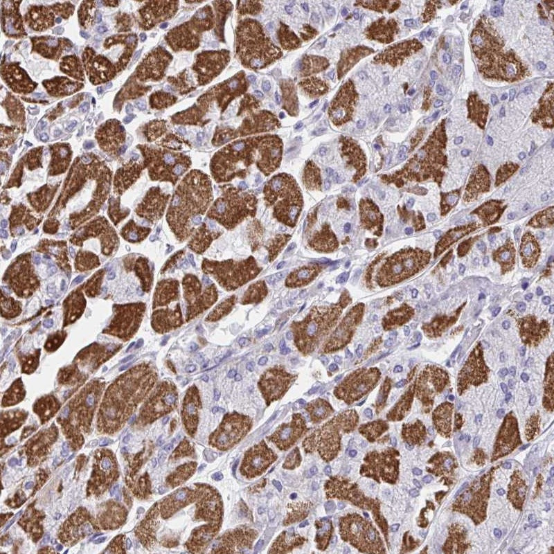 Immunohistochemical staining of human stomach, upper shows strong cytoplasmic positivity in parietal cells.