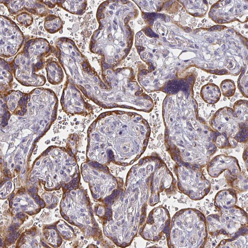 Immunohistochemical staining of human placenta shows strong cytoplasmic positivity in trophoblastic cells.