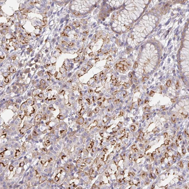 Immunohistochemical staining of human stomach, upper shows strong membranous and cytoplasmic positivity in glandular cells.