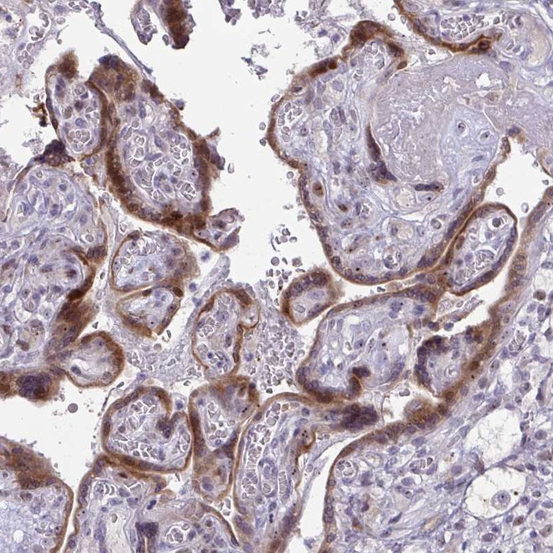 Immunohistochemical staining of human placenta shows cytoplasmic and nuclear positivity in trophoblastic cells.