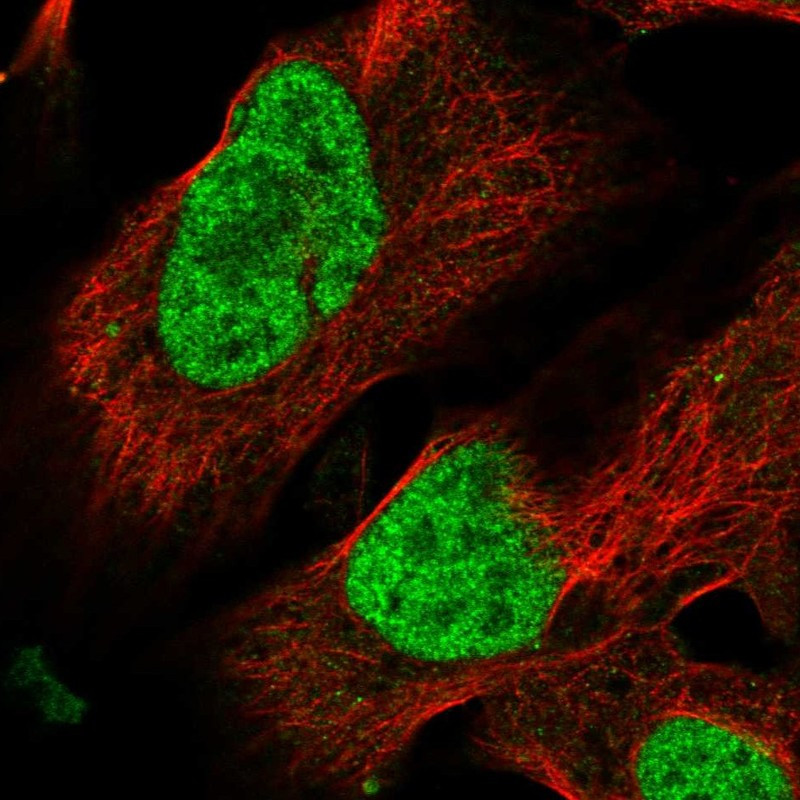 Immunofluorescent staining of human cell line U-2 OS shows localization to nucleoplasm.