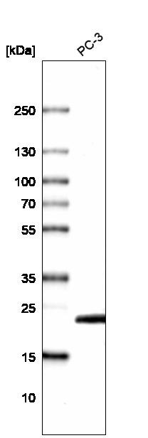 Lane 1: Marker [kDa] 250, 130, 100, 70, 55, 35, 25, 15, 10<br/>Lane 2: Human cell line MCF-7