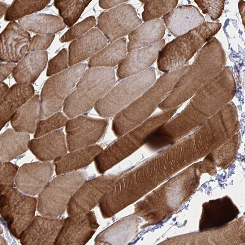 Immunohistochemical staining of human skeletal muscle shows strong cytoplasmic positivity in myocytes.