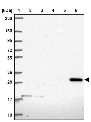 Lane 1: Marker [kDa] 250, 130, 95, 72, 55, 36, 28, 17, 10<br/>Lane 2: Human cell line RT-4<br/>Lane 3: Human cell line U-251MG sp<br/>Lane 4: Human plasma (IgG/HSA depleted)<br/>Lane 5: Human liver tissue<br/>Lane 6: Human tonsil tissue