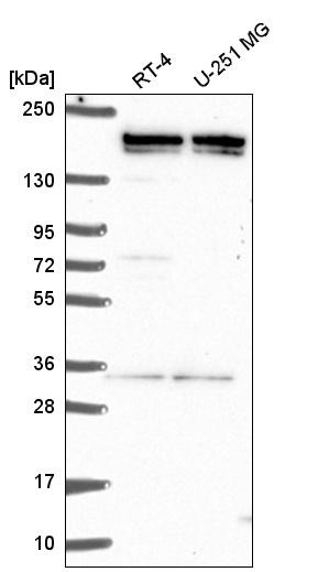Western blot analysis in human cell line RT-4 and human cell line U-251 MG.