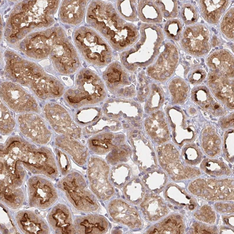Immunohistochemical staining of human kidney shows strong cytoplasmic and membranous positivity in cells in tubules.