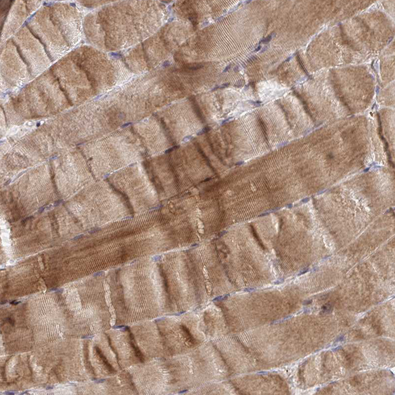 Immunohistochemical staining of human skeletal muscle shows strong cytoplasmic positivity in myocytes.