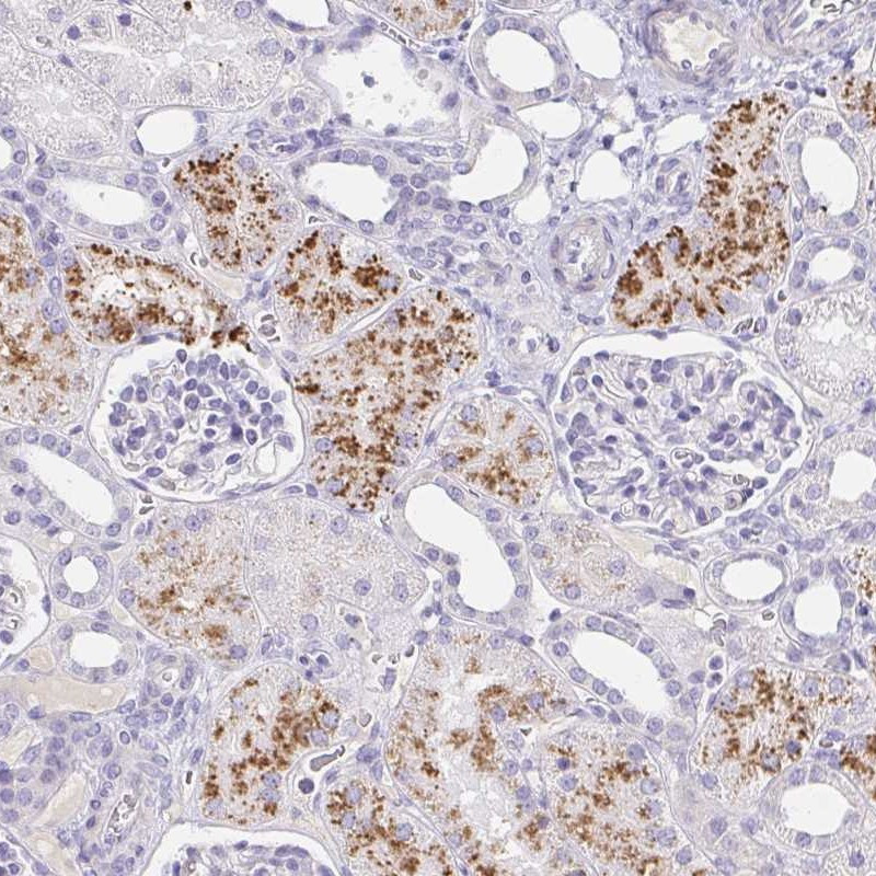 Immunohistochemical staining of human kidney shows strong cytoplasmic positivity in cells in tubules.