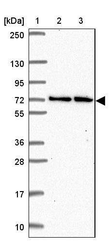 Lane 1: Marker [kDa] 250, 130, 95, 72, 55, 36, 28, 17, 10<br/>Lane 2: Human cell line RT-4<br/>Lane 3: Human cell line U-251MG sp