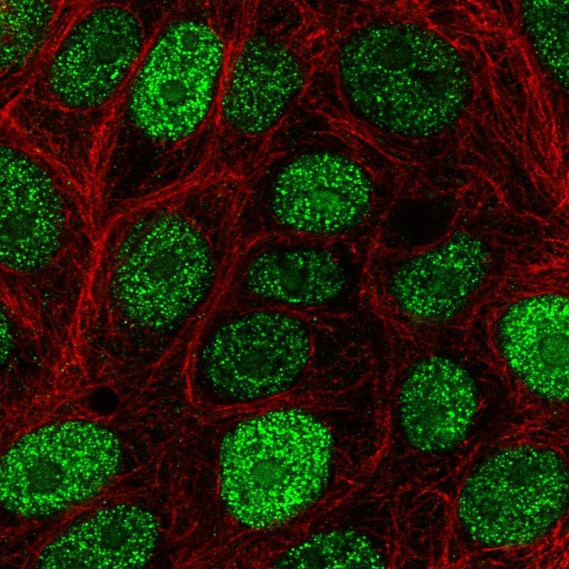 Immunofluorescent staining of human cell line MCF7 shows localization to nucleus & nucleoli.