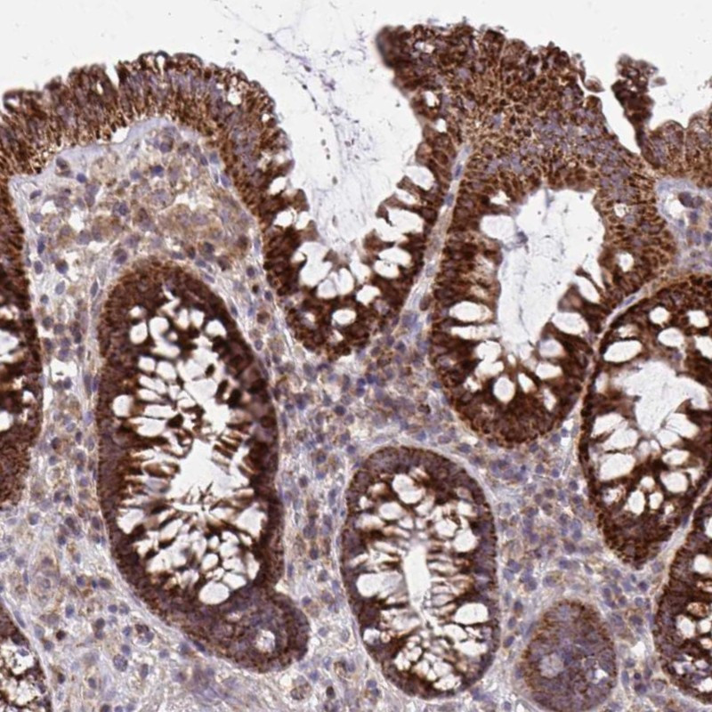 Immunohistochemical staining of human colon shows strong cytoplasmic positivity in glandular cells.