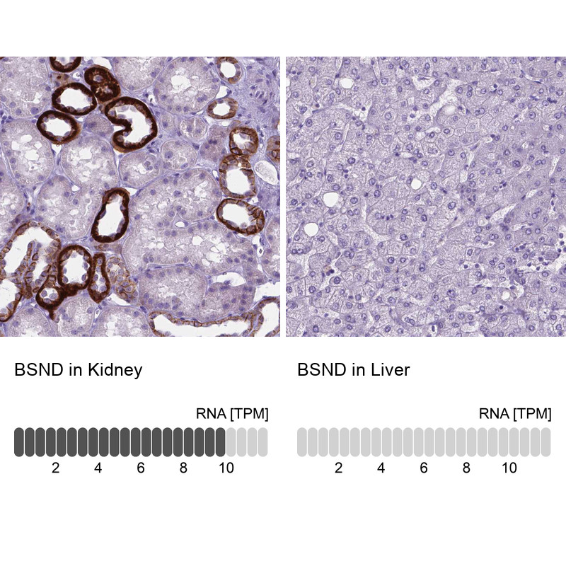 Immunohistochemistry analysis in human kidney and liver tissues using HPA060617 antibody. Corresponding BSND RNA-seq data are presented for the same tissues.