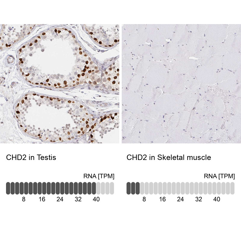 Immunohistochemistry analysis in human testis and skeletal muscle tissues using HPA060744 antibody. Corresponding CHD2 RNA-seq data are presented for the same tissues.