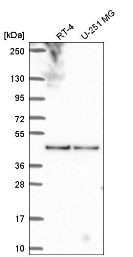 Western blot analysis in human cell line RT-4 and human cell line U-251 MG.