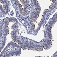 Immunohistochemical staining of human fallopian tube shows strong ciliary positivity in glandular cells.