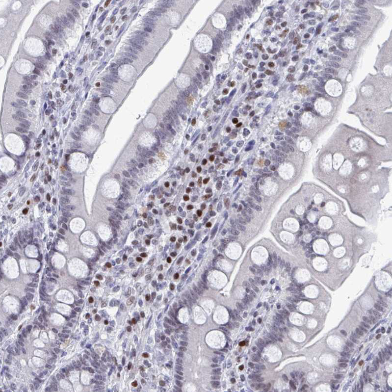 Immunohistochemical staining of human duodenum shows strong nuclear positivity in lymphoid cells.