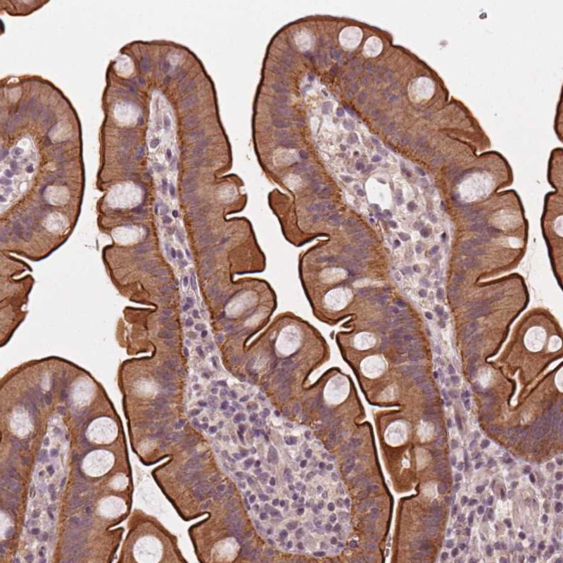 Immunohistochemical staining of human small intestine shows strong cytoplasmic and membranous positivity in glandular cells.