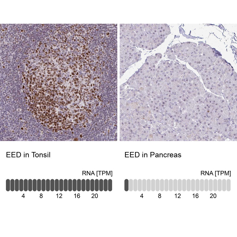 Immunohistochemistry analysis in human tonsil and pancreas tissues using HPA061140 antibody. Corresponding EED RNA-seq data are presented for the same tissues.